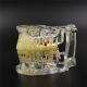 Dental Study Tooth Transparent Adult Pathological & Disease Teeth Model