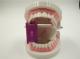 Dental Autoclavable occlusal pad big size + Oral block tongue kit