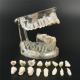 New Dental Study Teaching Model Disease Model Removable Teeth