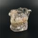 NEW Dental Implant Study Analysis Demonstration Teeth Model with Restoration 