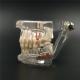 NEW Dental Implant Study Analysis Demonstration Teeth Model with Restoration 