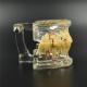 Dental Study Tooth Transparent Adult Pathological & Disease Teeth Model