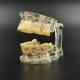 Dental Study Tooth Transparent Adult Pathological & Disease Teeth Model