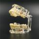 1 X  Dental Implant Disease Tooth Pathological Extrusion Missing Teeth Model