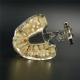 1 X  Dental Implant Disease Tooth Pathological Extrusion Missing Teeth Model