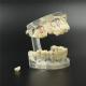 Dental Teeth Study Model Classic Implant Typodont Model Restoration removable