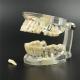 Dental Teeth Study Model Classic Implant Typodont Model Restoration removable