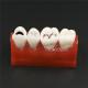 Dental Cavity Sealing Demonstration tooth Model teeth study
