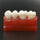 Dental Cavity Sealing Demonstration tooth Model teeth study