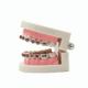 Dental Imaging System Portable Digital X-Ray Machine Equipment High Frequency 110V