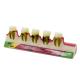 Dental Periodontal Disease assort Teeth Dentoform Typodont Study Teaching Model