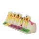 Dental Caries Developing illusteation Tooth Model Demonstration Teach Patient