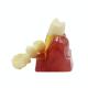 MACRO IMPLANT MODEL CROWN BRIDGE DEMOSTRATATION TEETH TOOH TYPODONT DENTOFORM