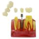 MACRO IMPLANT MODEL CROWN BRIDGE DEMOSTRATATION TEETH TOOH TYPODONT DENTOFORM